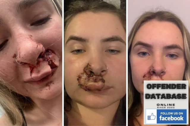 Ella Downing injuries