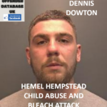 DENNIS DOWTON HEMEL HEMPSTEAD CHILD ABUSE AND BLEACH ATTACK